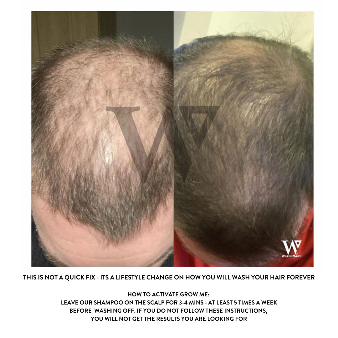 Grow Me Shampoo - DHT Blocker - SAVE MY HAIR