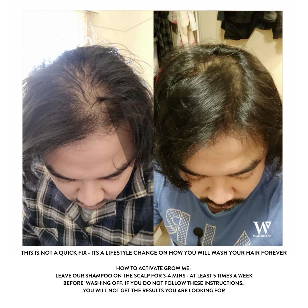 Grow Me Shampoo - DHT Blocker - SAVE MY HAIR