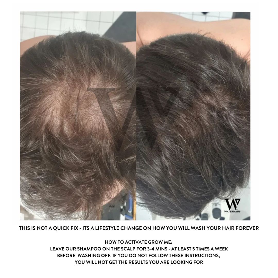 Grow Me Shampoo - DHT Blocker - SAVE MY HAIR